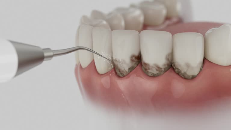 Trusted Root Canal Treatment service in Warsaw, NC - Dentist Open Now